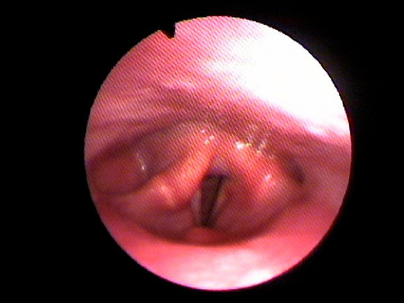 4. close up voice box