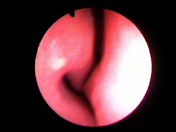1. right nose