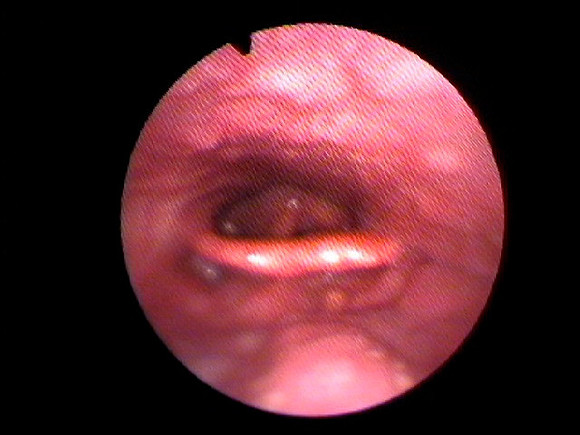 3. throat sitting up